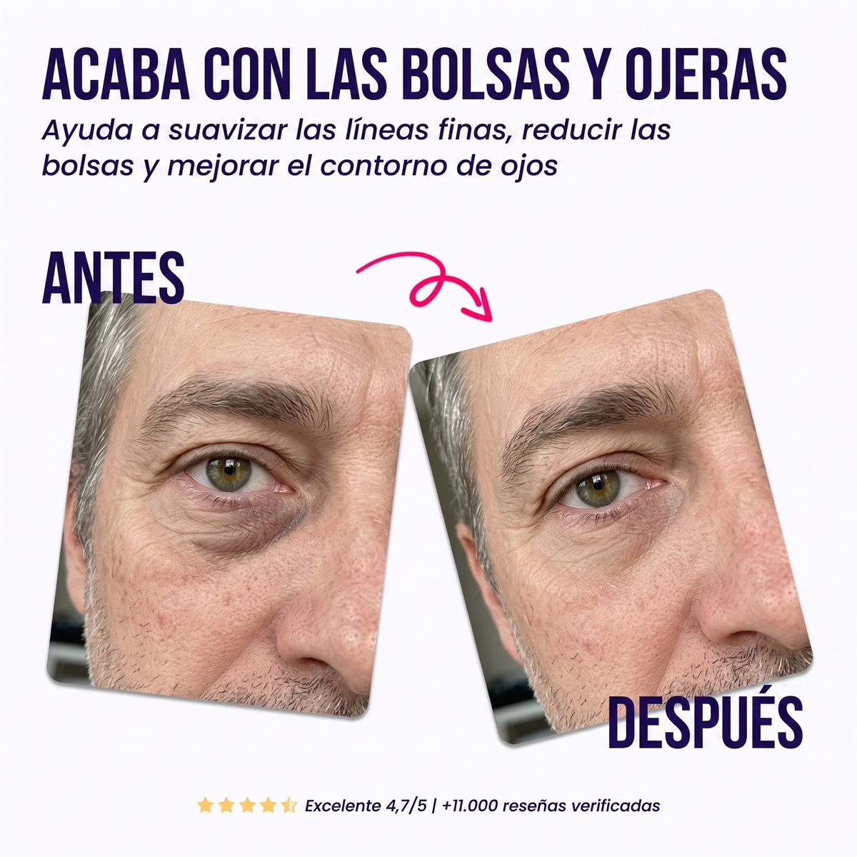 Parches Reparadores para el Contorno de Ojos