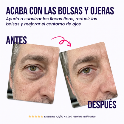 Parches Reparadores para el Contorno de Ojos
